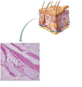 Photomicrograph of a sectioned sebaceous gland