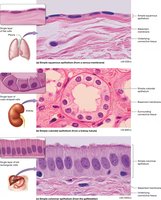 Micrograph of pseudostratified columnar epithelium