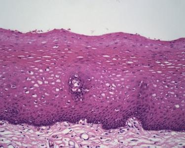Stratified squamous epithelium