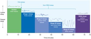 Stages of wakefulness and sleep as shown by EEG patterns