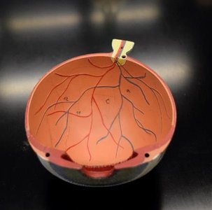 Model showing the retina and optic disc