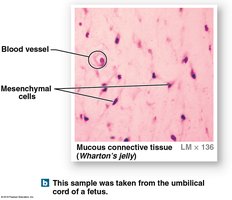 Mucous connective tissue from umbilical cord