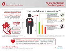 Ejection fraction and heart failure