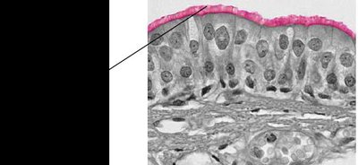 Ciliated pseudostratified columnar epithelium