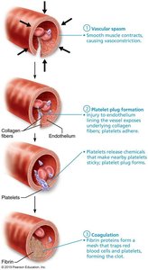 Hemostasis: vascular spasm, platelet plug, coagulation