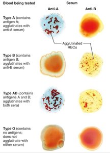 Hemolytic disease of the newborn mechanism