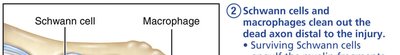 Schwann cells and macrophages clean debris