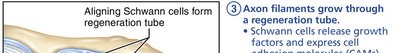 Axon regenerates and new myelin sheath forms