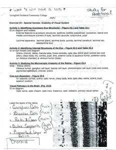 Histological section of the retina showing labeled layers: ganglion cells, bipolar cells, rods & cones, outer segments, pigmented layer, and choroid.