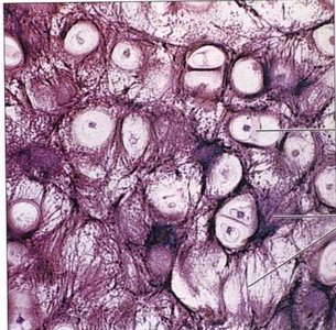 Histological section of fibrocartilage