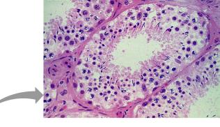 Histological section of seminiferous tubule
