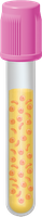 Solution, colloid, and suspension comparison