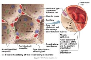 Illustration of 2 alveoli with different sizes and the how the Law of LaPlace applies to them