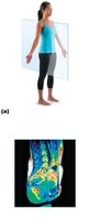 Sagittal plane and MRI scan