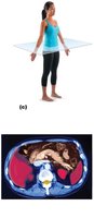 Transverse plane and MRI scan