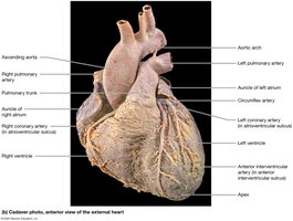 Cadaver photo of the anterior view of the heart
