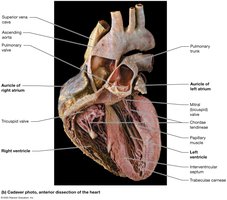 Cadaver photo of the anterior dissection of the heart