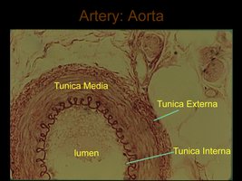 Histological section of artery wall layers