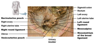 Dissection of female pelvic ligaments and organs