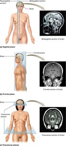 Planes of section: sagittal, frontal, and transverse