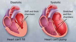 CHF symptoms and effects