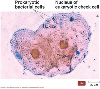 Comparison of microbial cells: Streptococcus and human cheek cell