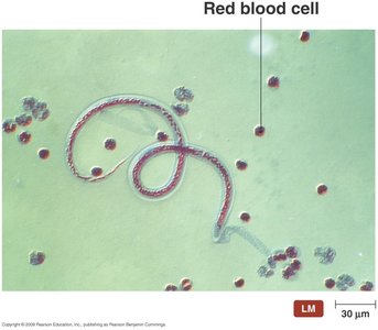 Parasitic fluke (worm) in the blood