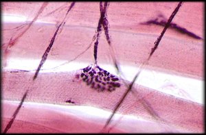 Neuromuscular junction structure