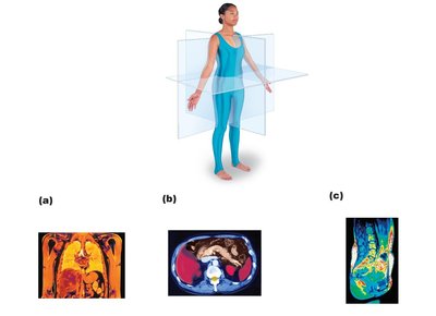 Body planes and MRI sections