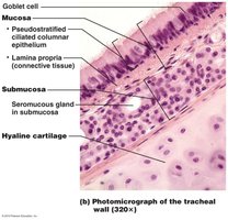 Photomicrograph of tracheal wall layers
