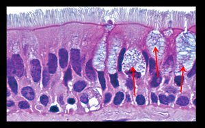Histology of respiratory mucosa with cilia and goblet cells