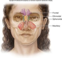 Diagram of paranasal sinuses in the skull