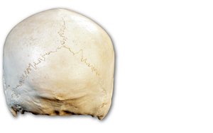 Posterior view of skull showing sutures