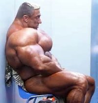 Bodybuilder with muscle hypertrophy (GH hypersecretion)