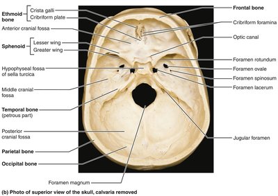 Lateral view of cranial fossae