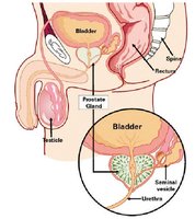 Diagram showing the prostate gland, seminal vesicle, bladder, and urethra in the male pelvis