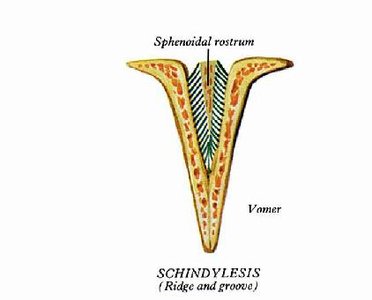 Schindylesis joint (ridge and groove)