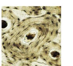 Microscopic structure of bone tissue