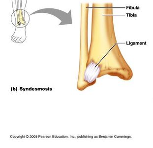 Gomphosis joint (tooth in socket)