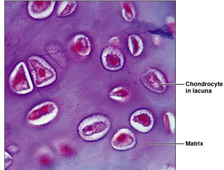Hyaline cartilage: chondrocytes in lacunae and matrix