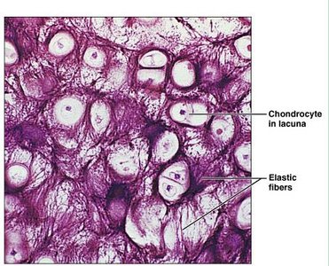Elastic cartilage: chondrocytes and elastic fibers