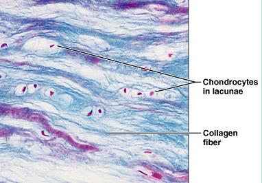 Fibrocartilage: chondrocytes and collagen fibers