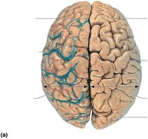Superior view of cerebral hemispheres