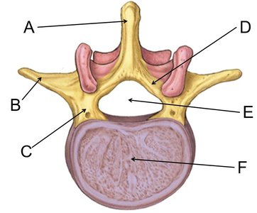 Typical vertebra with labels A–F