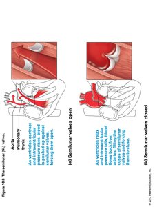 Heart Valves - Chordae Tendineae
