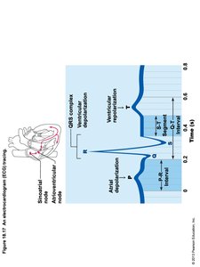 Normal and Abnormal ECG Tracings