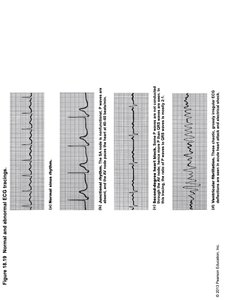 Summary of Events During the Cardiac Cycle