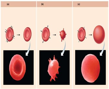 Red blood cells in isotonic, hypertonic, and hypotonic solutions