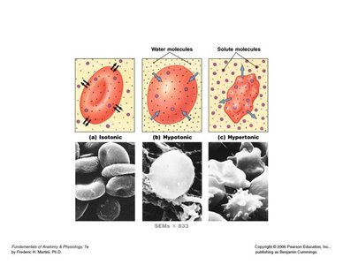 SEM images of red blood cells in different tonicities