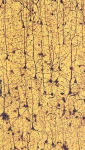 Histological image of neurons and glia